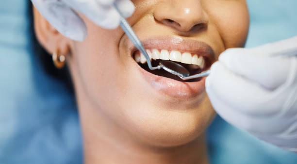 Best Emergency Dental Care for Abscessed Tooth in Powell, WY