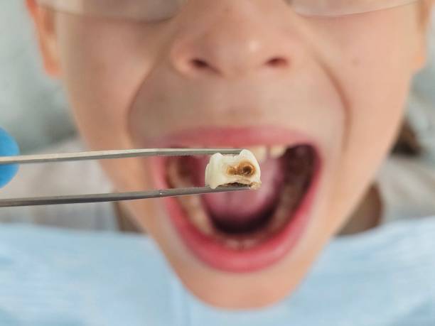 Best Holiday Emergency Dentist in Powell, WY